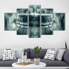X-ray Dental Face Wall Art Decor Canvas Printing