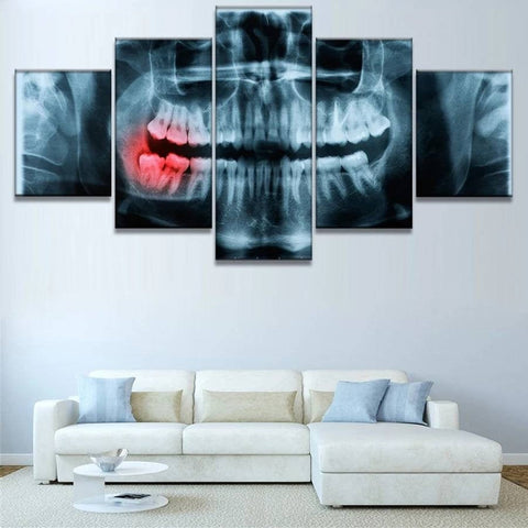 Dentist Teeth Xray Wall Art Decor Canvas Printing